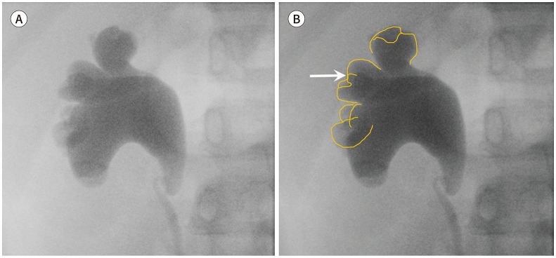 Fig. 11