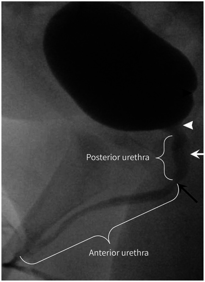 Fig. 13