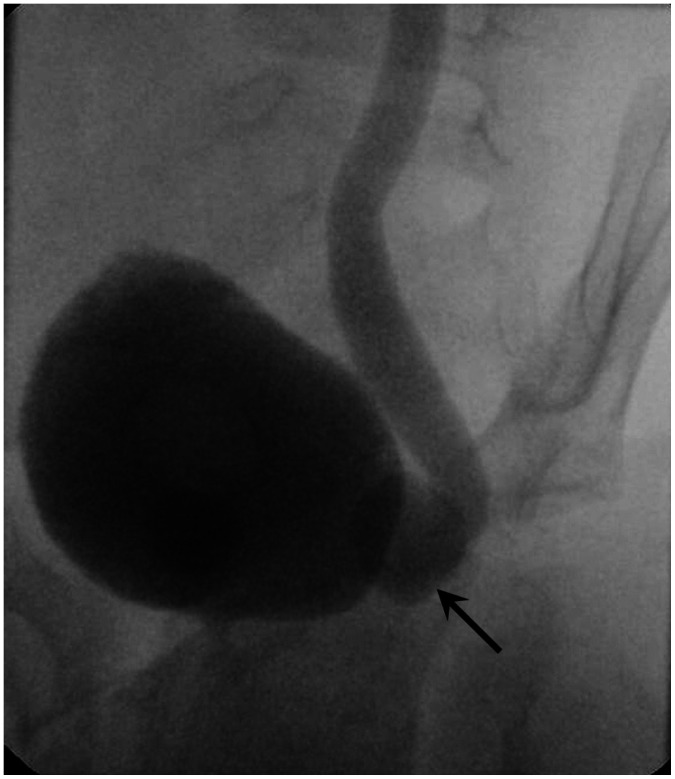 Fig. 17