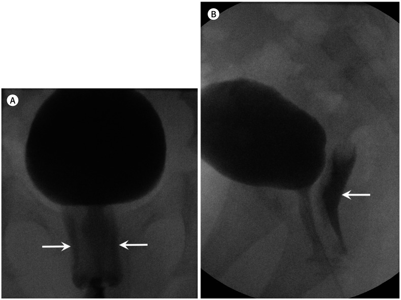 Fig. 15