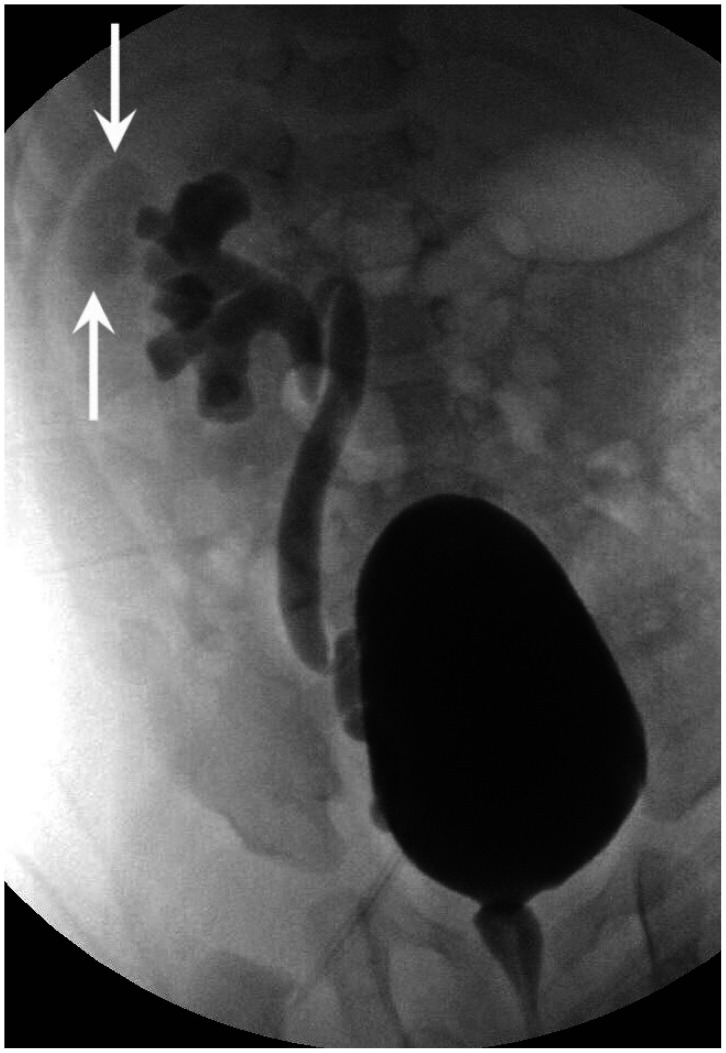 Fig. 16