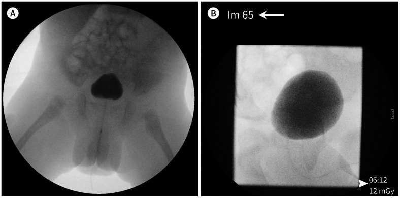 Fig. 19