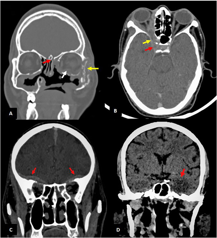 Fig. 4