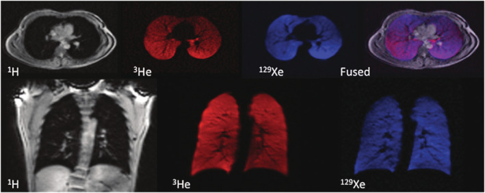 FIGURE 6