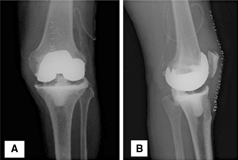 Fig. 1A–B