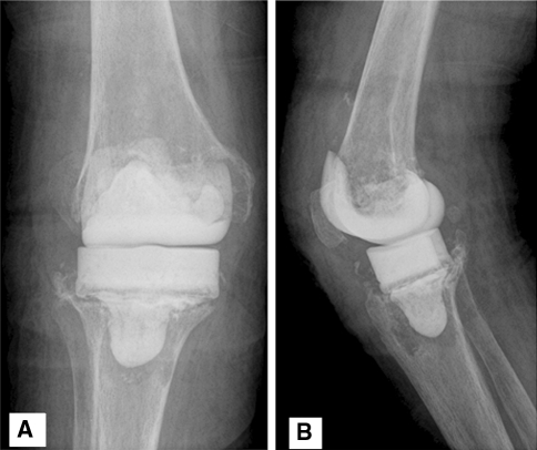 Fig. 2A–B