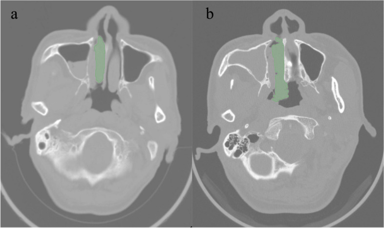Fig. 2