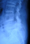 Fig. 1