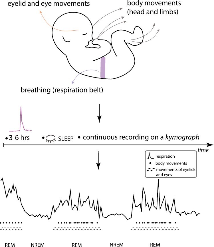 Graphical Abstract