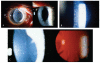 FIGURE 22