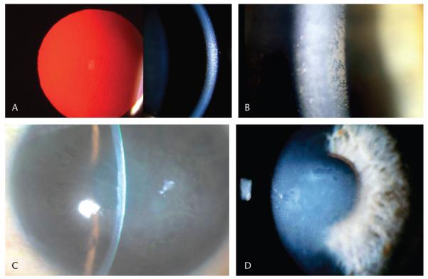 FIGURE 21