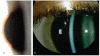 FIGURE 20