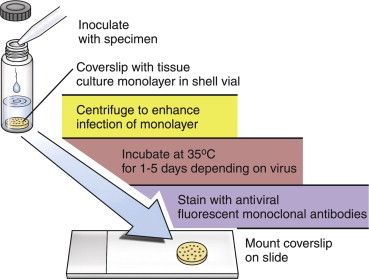 FIGURE 1-4