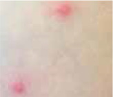 graphic file with name PDIA-37-36747-inline003.jpg