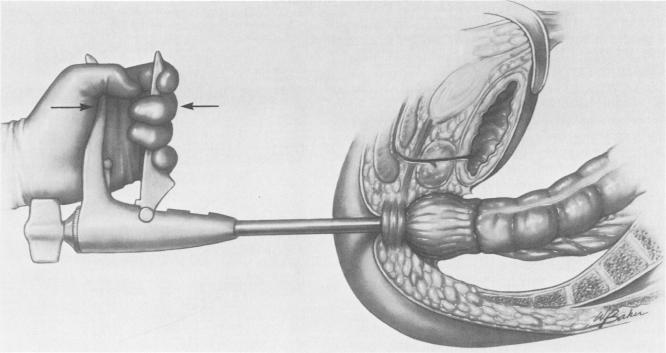 Fig. 1f.