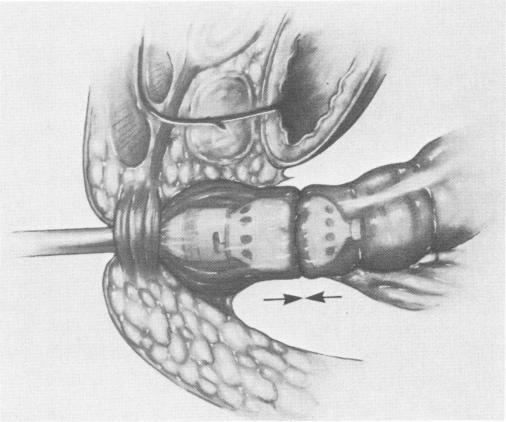 Fig. 1e.