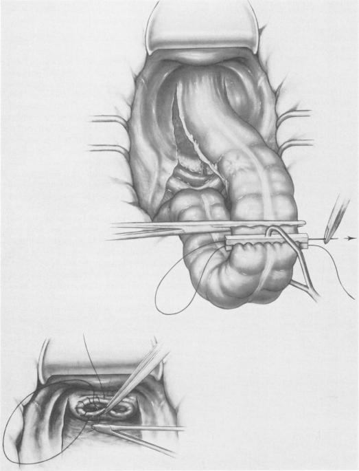 Fig. 1a.