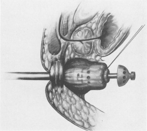 Fig. 1c.