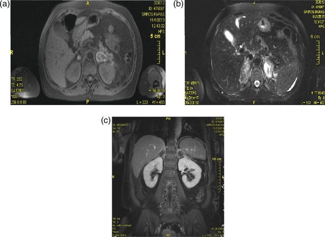 Figure 2: