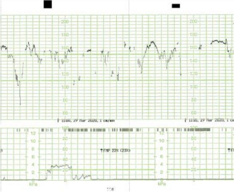 Fig. 4