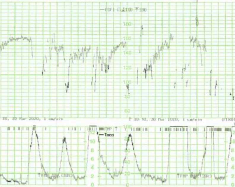 Fig. 2