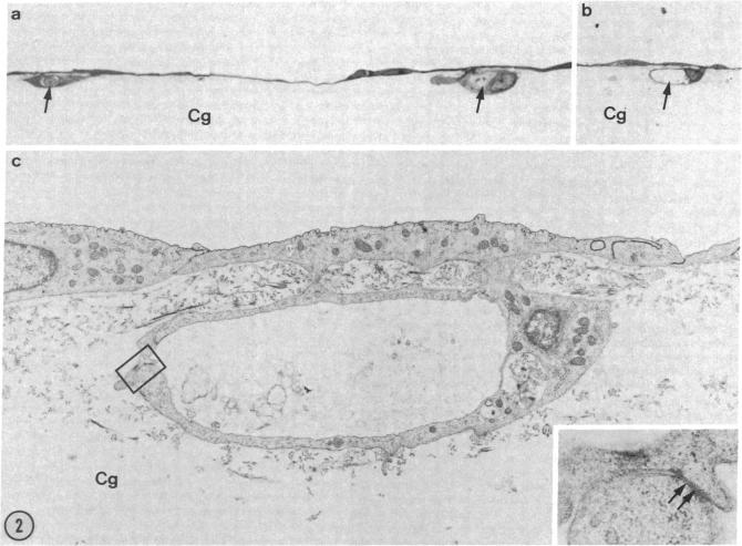 graphic file with name pnas00323-0179-a.jpg