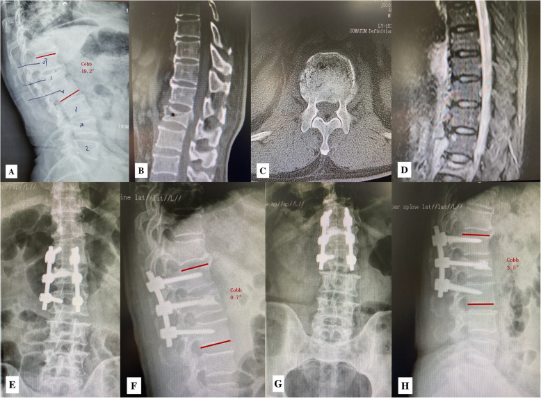 Fig. 1