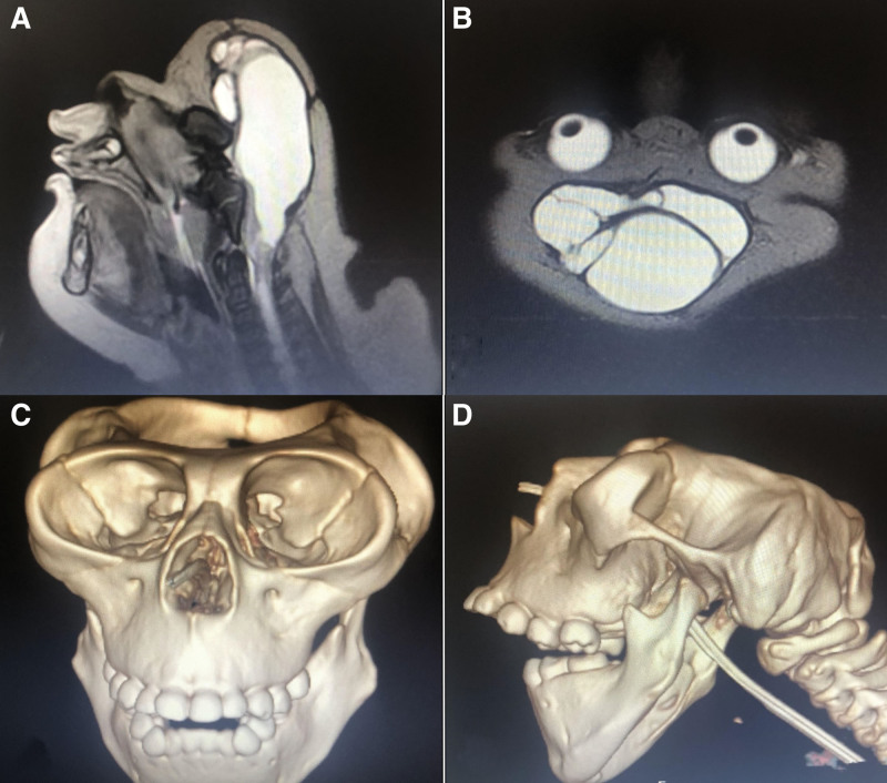 Figure 4.