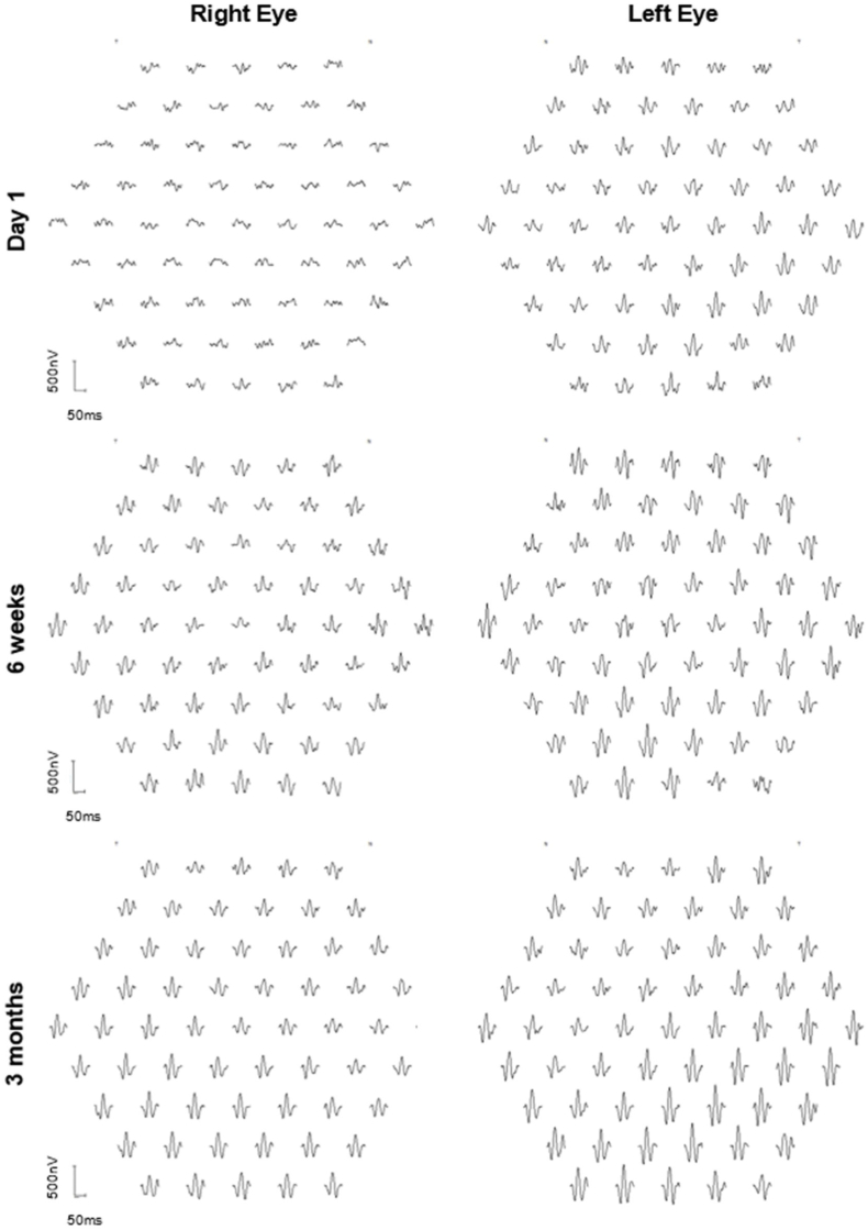 Fig. 4