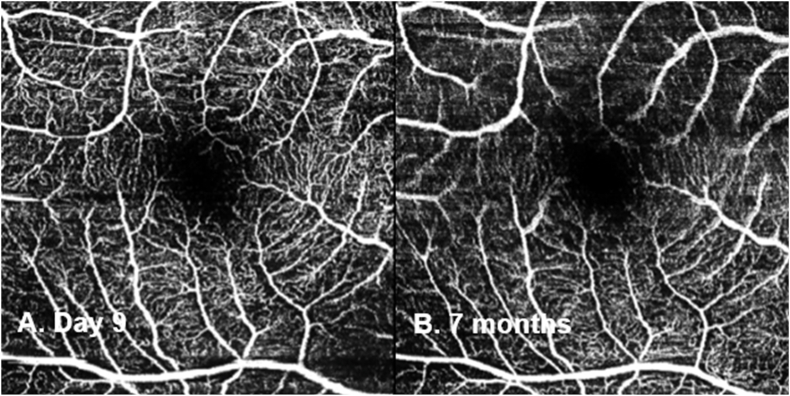 Fig. 6