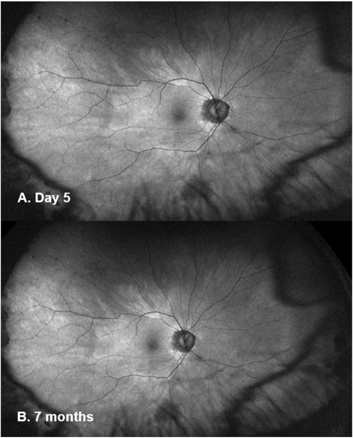 Fig. 5