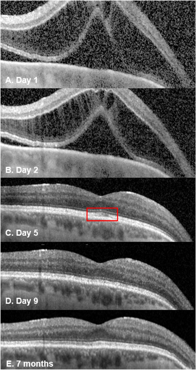 Fig. 2