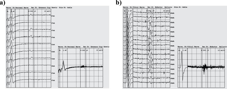 Fig. (1)