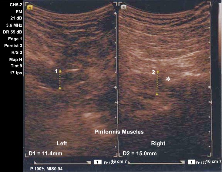 Fig. (2)