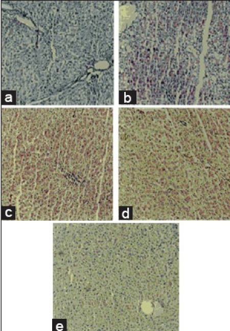 Figure 1b