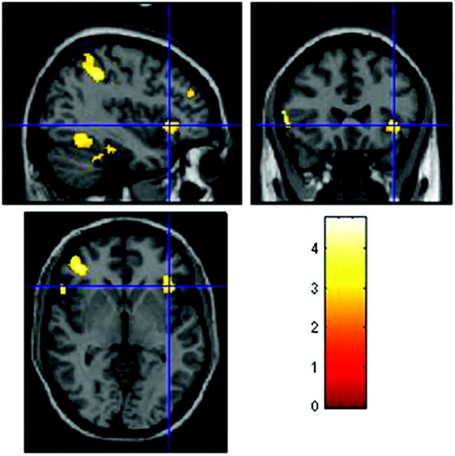 Fig 2.