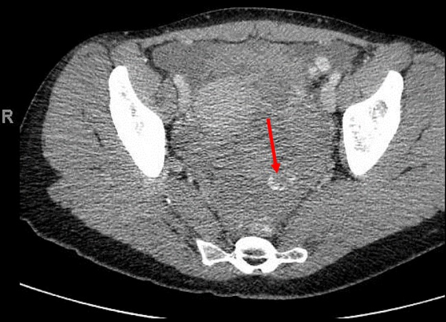 Figure 2: