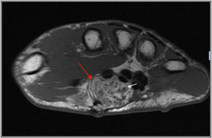 Fig. 14