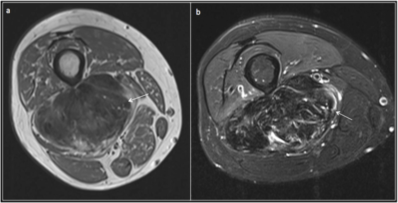 Fig. 7