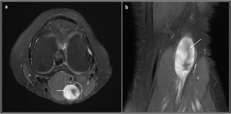 Fig. 9