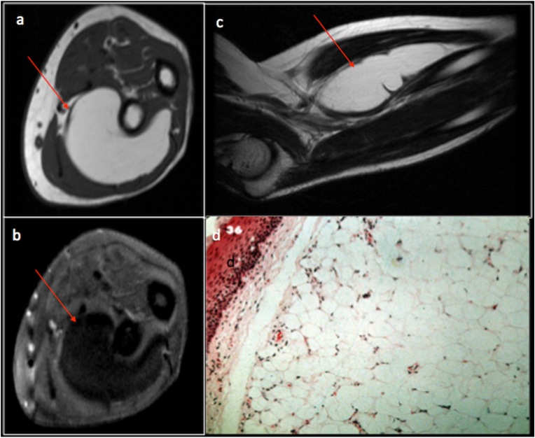 Fig. 1