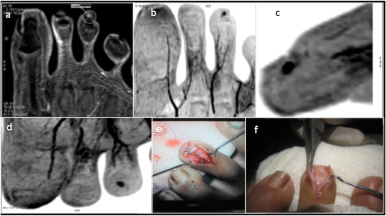 Fig. 16