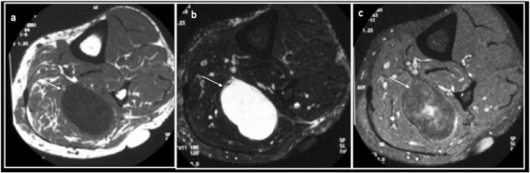 Fig. 4