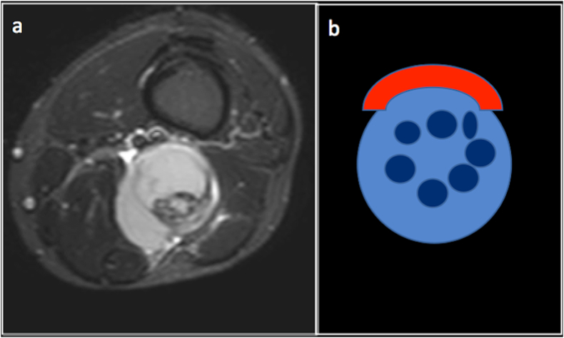 Fig. 11