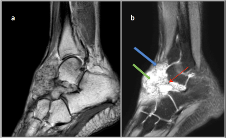 Fig. 13