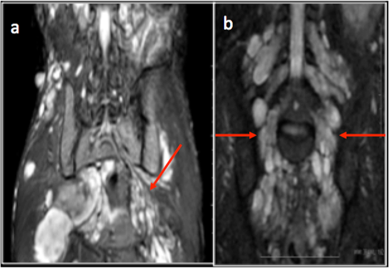 Fig. 10