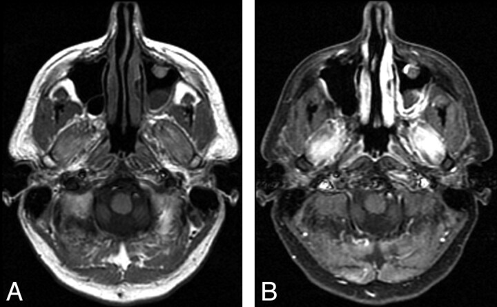 Fig 2.