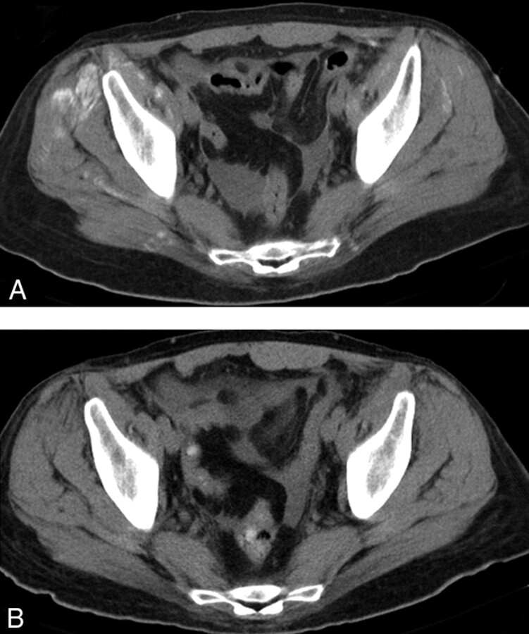 Fig 3.