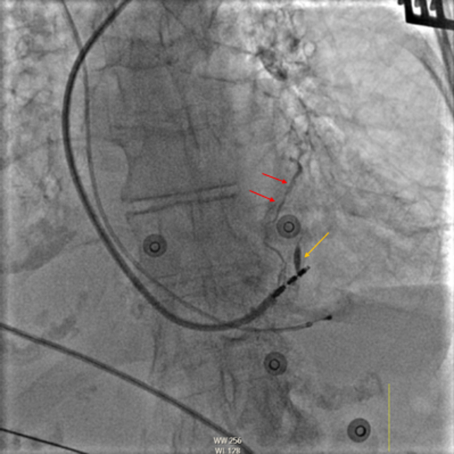 Figure 1