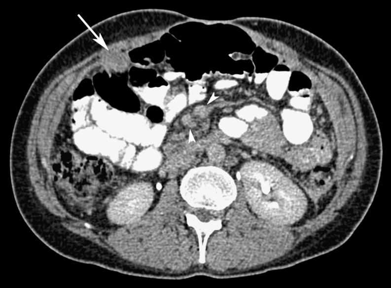 Fig. 24